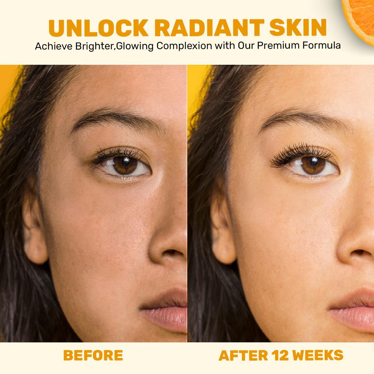 SOWANI Gentle Vitamin C Serum – Brightening & Hydrating with Citrus Stem Cells and Chamomile, Safe for Rosacea & Sensitive Skin, 1oz