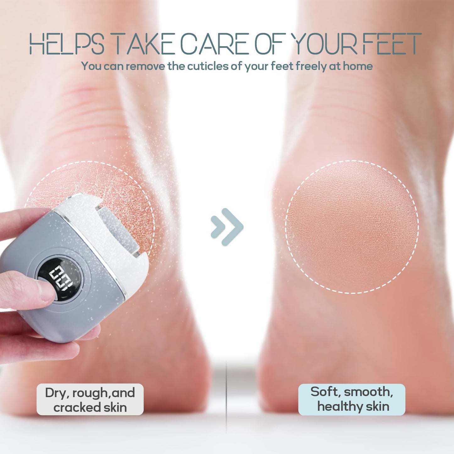 KAZLIE Electric Foot Callus Remover, Rechargeable & Waterproof Pedicure Tool with 3 Roller Heads, 2 Speeds for Dead, Hard, Cracked, Dry Skin Care