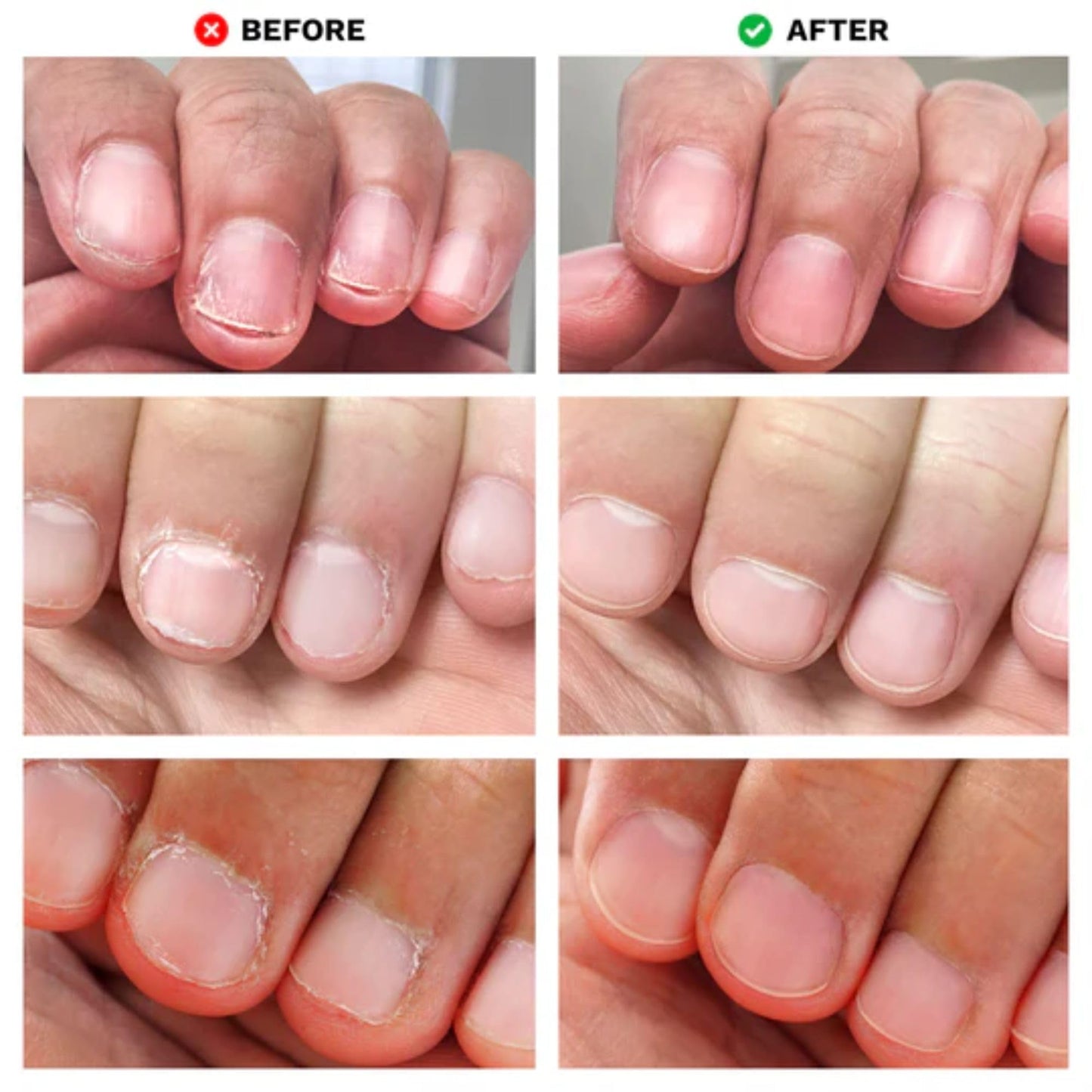 LONDONTOWN No Bite Nail Recovery - Nail Biting Thumb Sucking Deterrent - Bitter Non Toxic Nail Biting Treatment for Kids Adults - Fortified Strengthener and Growth Care Formula .40fl oz