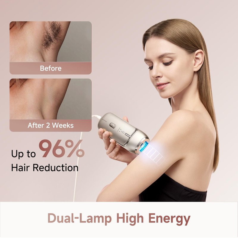 Dreame Nova IPL Hair Removal with Dual-Lamp 27J Output, Sapphire ICE Cooling, 3.9cm² Window, 0.2s Flash, Adaptizone AI Detection, Photon Skincare, Up to 96% Reduction Full-Body for Women and Men
