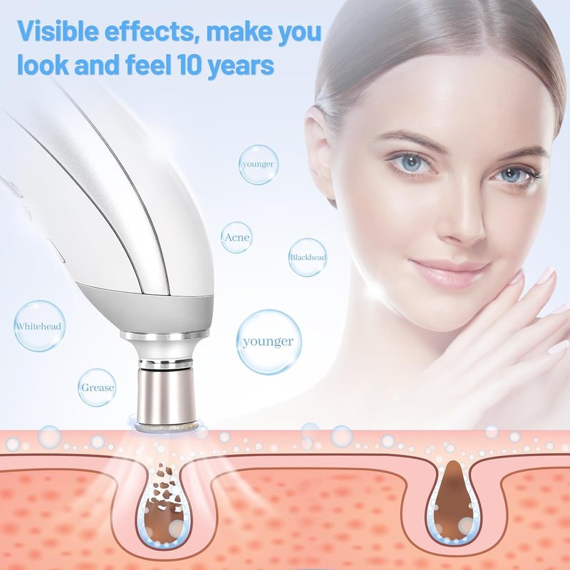 Microdermabrasion Machine - Portable Facial Skin Care Tool | Blackhead Remover Kit for Home Use
