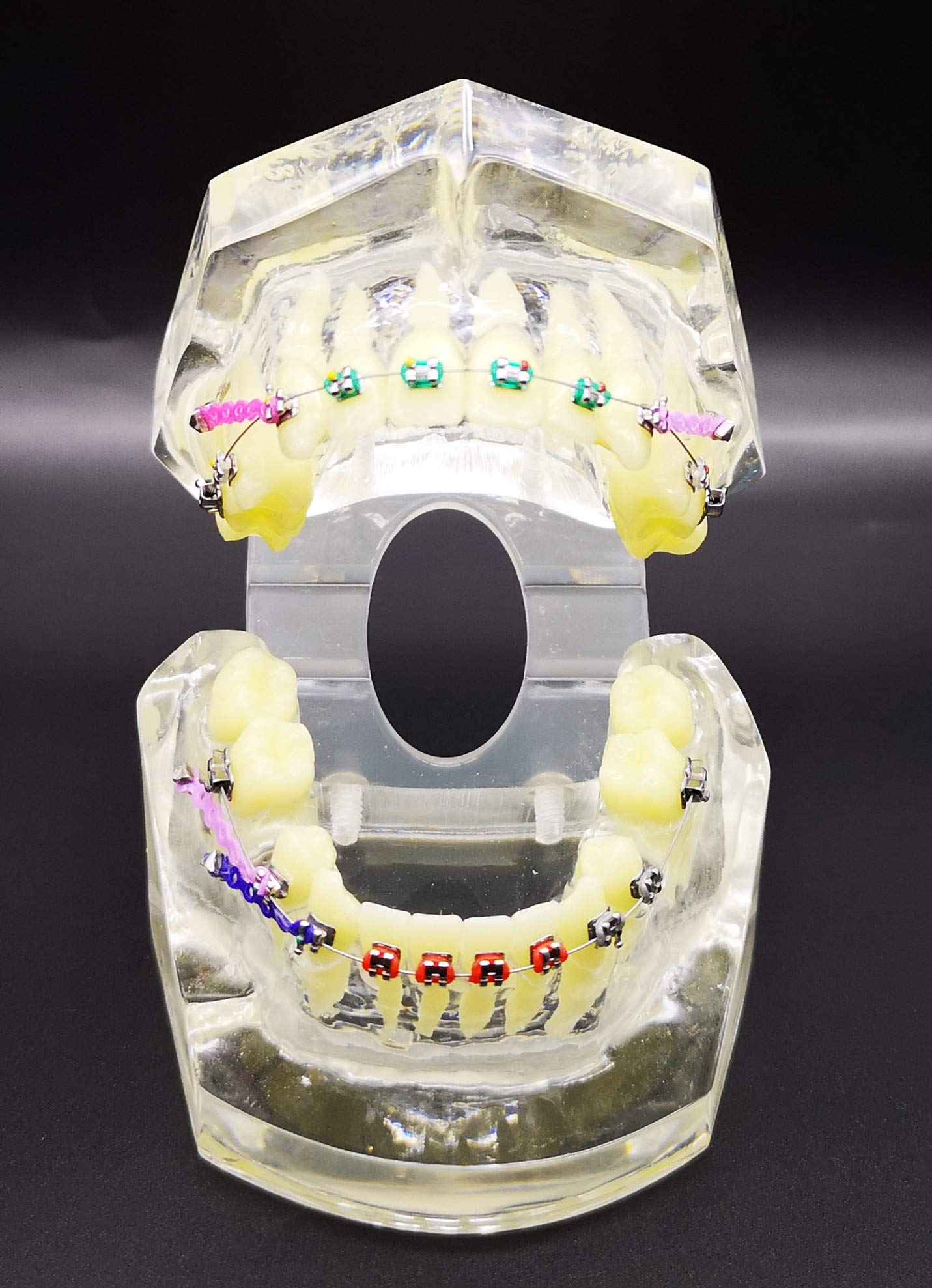 Dental Typodont with Metal Brackets Orthodontic Teeth Model with Ligature Tie