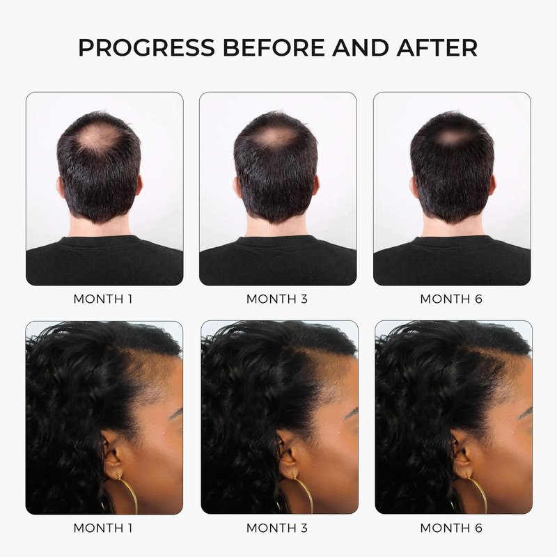 Rivermint Premium Hair Strengthening Shampoo Castor Oil, Biotin, Avocado Oil, Caffeine, Saw Palmetto, Onion, and Redensyl Hair Regrowth & Thickening Support Sulfate-Free, Paraben-Free, for Men & Women