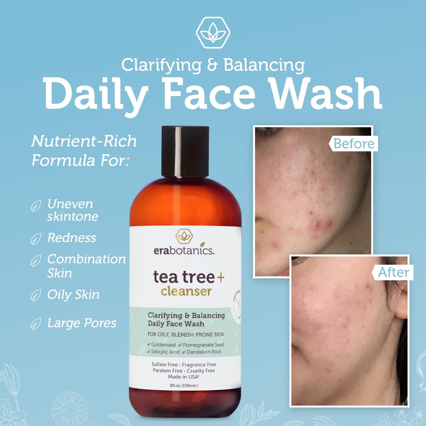 Era Organics Purifying Tea Tree Oil Face Wash - Balancing Cleanser for Oily, Blemish-Prone Skin with Salicylic Acid - Sulfate-Free, Fragrance Free, Made in USA