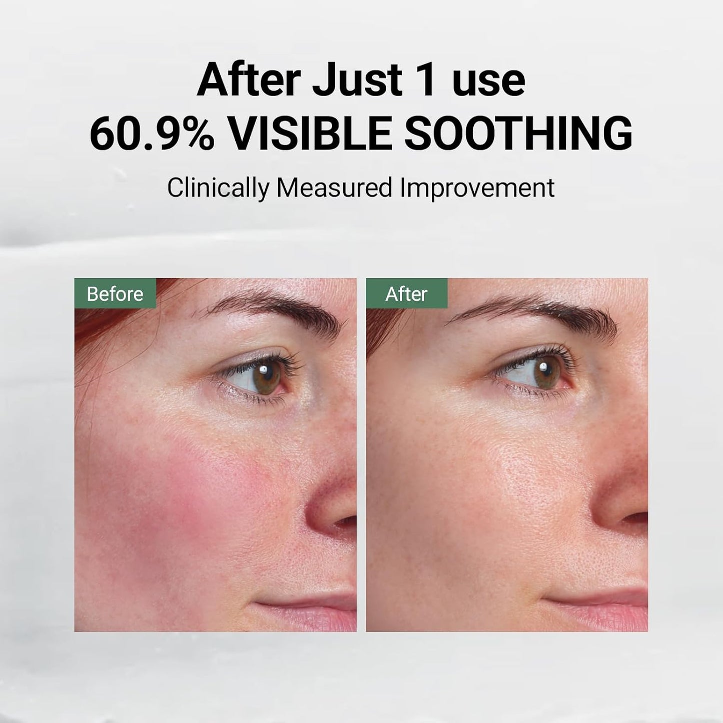 DA EFFECT Post Care Balm - Hydrating Face Moisturizer with TECA & Ginseng Exosome | Soothes Redness & Dryness, 30ml
