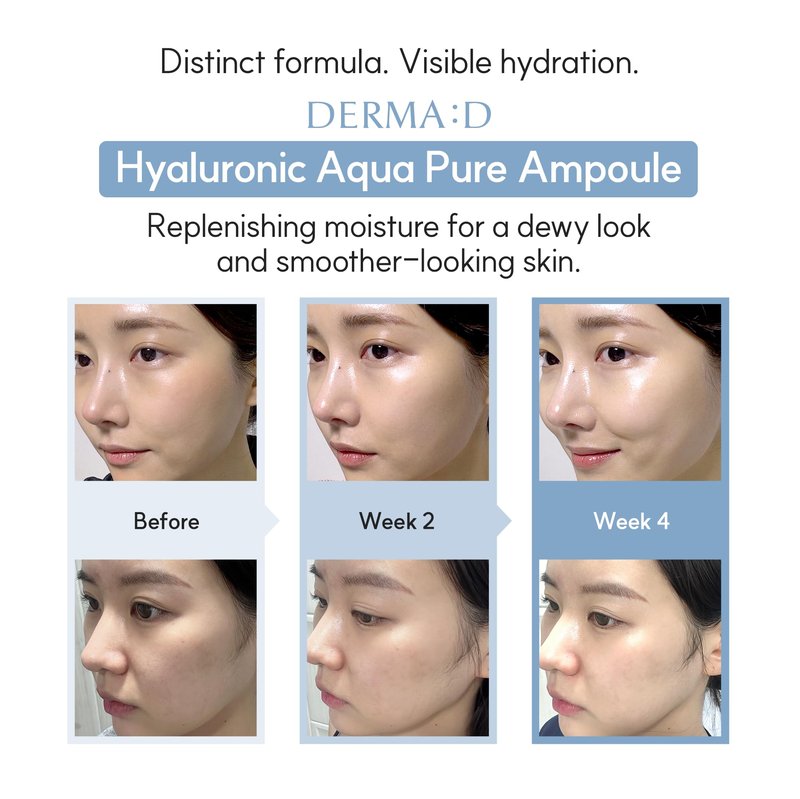 DERMA:D Lightweight Hydrating Serum for Sensitive Skin, Korean Hyaluronic Acid Ampoule with Panthenol & Retinol, Non Sticky Water Based Moisture Care, 1.69 fl oz