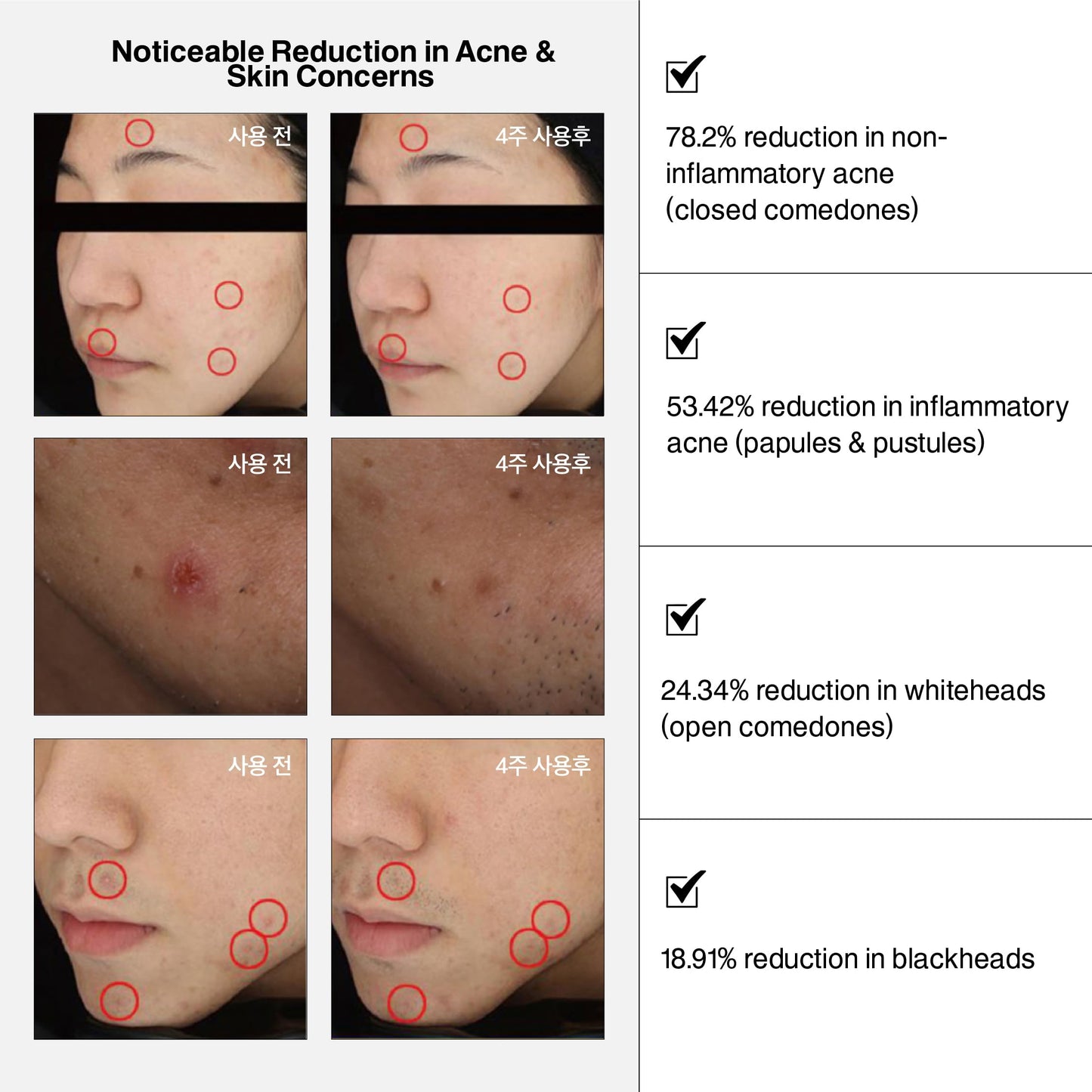 NURICLE Betelchlorous S.O.S Rescue Dose – Hypochlorous Acid Face Serum for Acne, Redness & Sensitive Skin, Soothing Korean Skincare Serum, 30ml (1.014 fl oz)