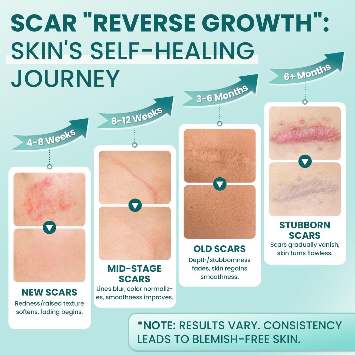 Scar Cream Gel Silicone Removal for Surgical Scars Burn Old Scars Acne Face Stretch Marks Hypertrophic Keloid wait Silicone Gel For Scars Topical Remover 2Pack 1.7 Oz