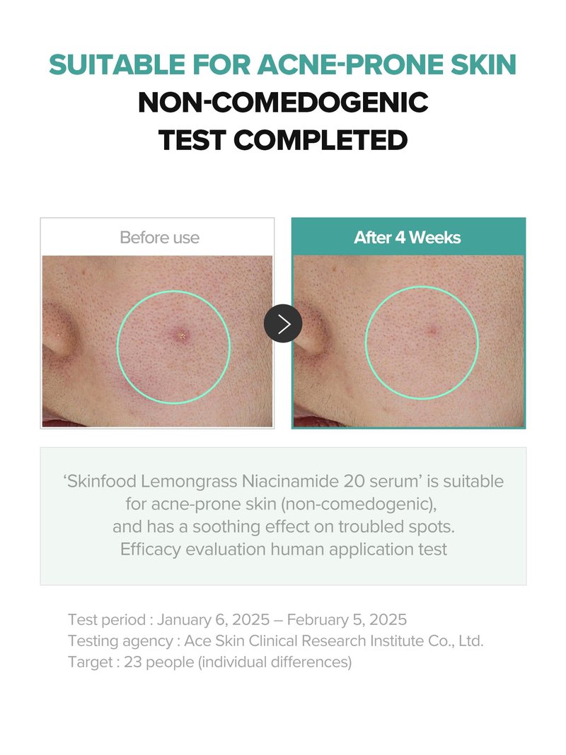 SKINFOOD Lemongrass Niacinamide 20% Serum, Korean Skincare Facial Serum for Oily & Sensitive Skin, Sebum Control, Moisture Balance, 50ml / 1.69 fl.oz.