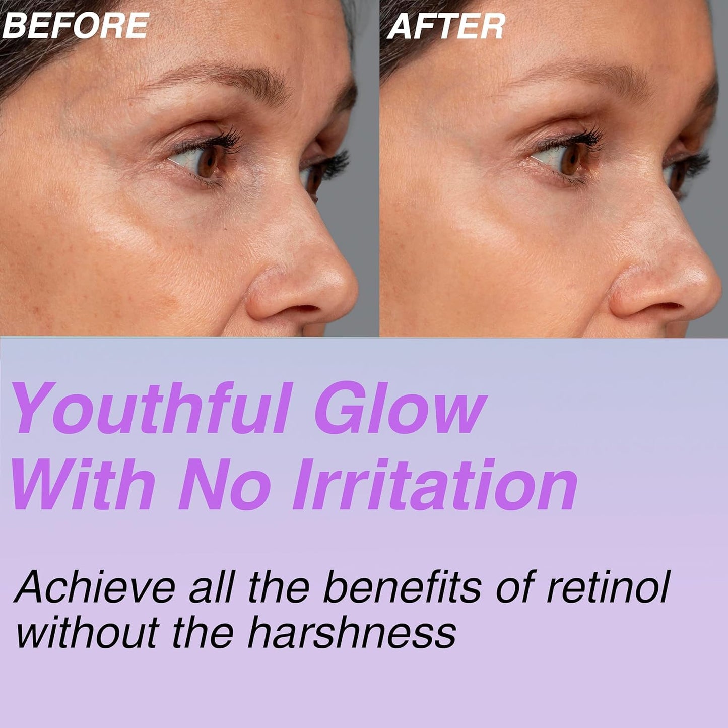 **CELDYQUE 100% Pure Volufiline & Bakuchiol Serum - High Potency Anti-Wrinkle Solution for Mature Skin | 30,000 ppm Concentrate**