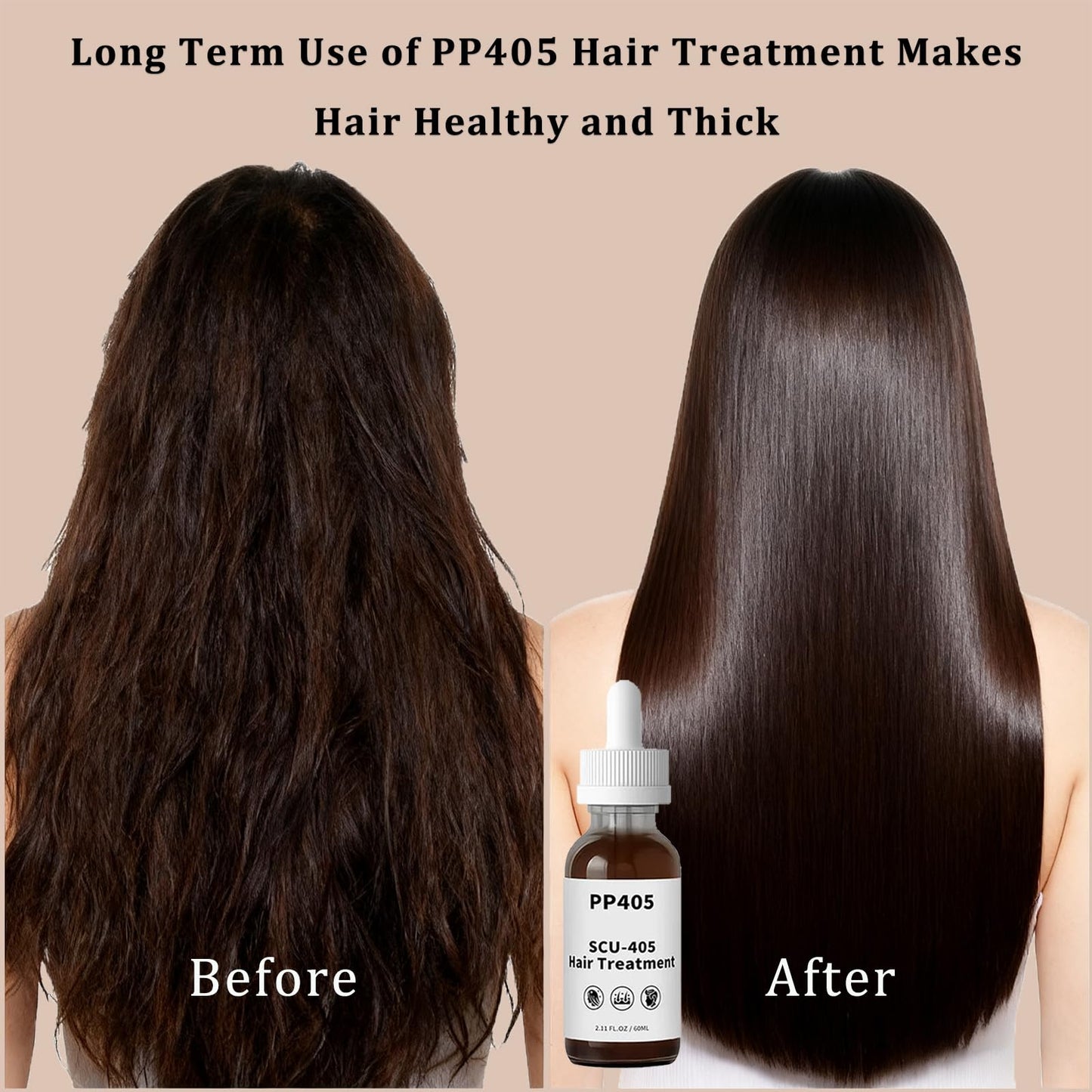 PP405 Hair Treatment, SCU-405 Hair Growth Oil, Infused with PP405 for Hairloss & Baldness, Hair Growth Serum for Women & men (2PCS)