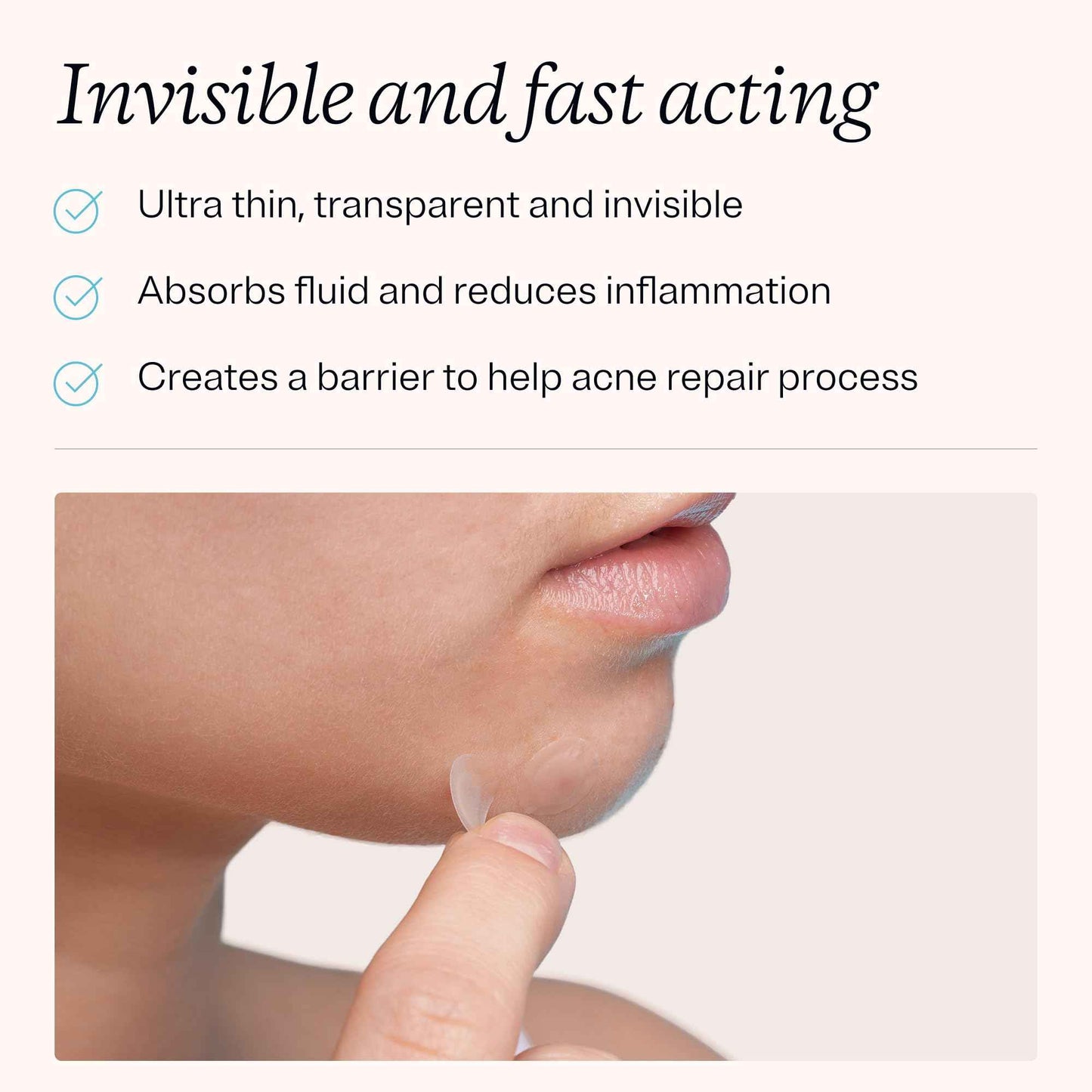 MDacne 72 Pimple Patches for Acne Treatment, Hydrocolloid Patches - Absorbs Oil & Pus from Clogged Pores, Ultrathin & Transparent Blends with All Skin Tones, Safe for Sensitive Skin (2 Pack of 36)