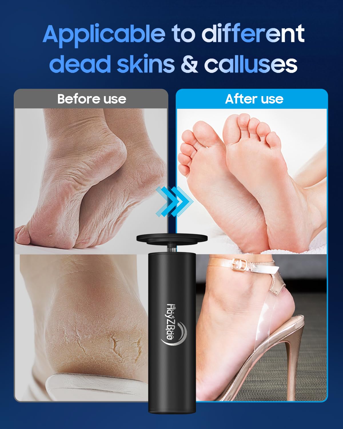 HayZBao Electric Foot Callus Remover - Electric Callus Remover for Feet,Foot Scrubber with 60 Pcs Sandpaper Discs,Professional Pedicure Tool for Dead Skin - Black