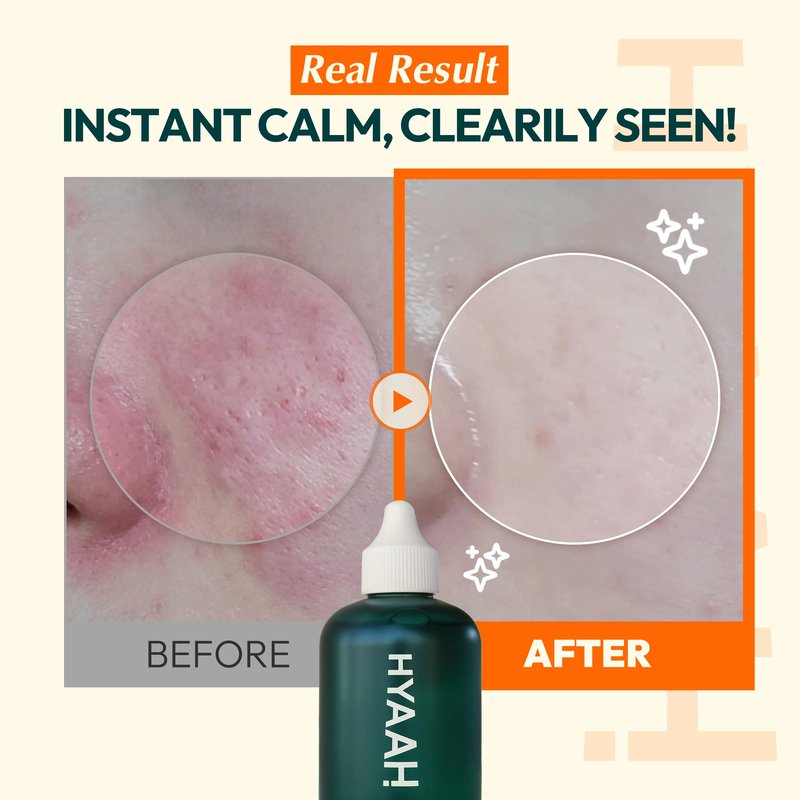 Hyaah Licorice First Essence – Soothing & Hydrating Facial Essence with Korean Licorice Root, Hyaluronic Acid & Allantoin, Lightweight Texture, Alcohol-Free, Korean Skincare