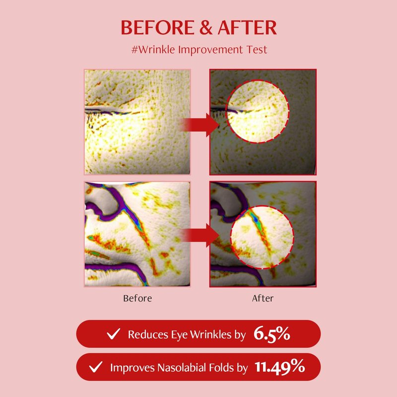 MEDITHERAPY Shumage Shot Gold Seal Lifting Ampoule, Gold Threads and Collagen Serum for Anti-wrinkles, Lifting Ampoule, Glowing Skin, Korean Skincare, 0.4 fl.oz.