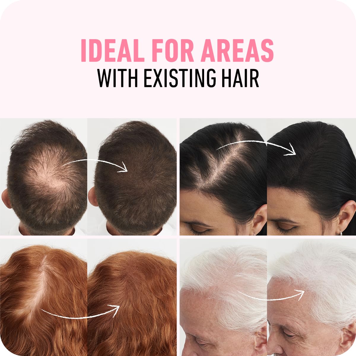 BOLDIFY Hair Fibers (28g) - Fill In Thinning and Fine Hair for an Instantly Fuller, Thicker Look - 14 Shades for Women & Men - Black