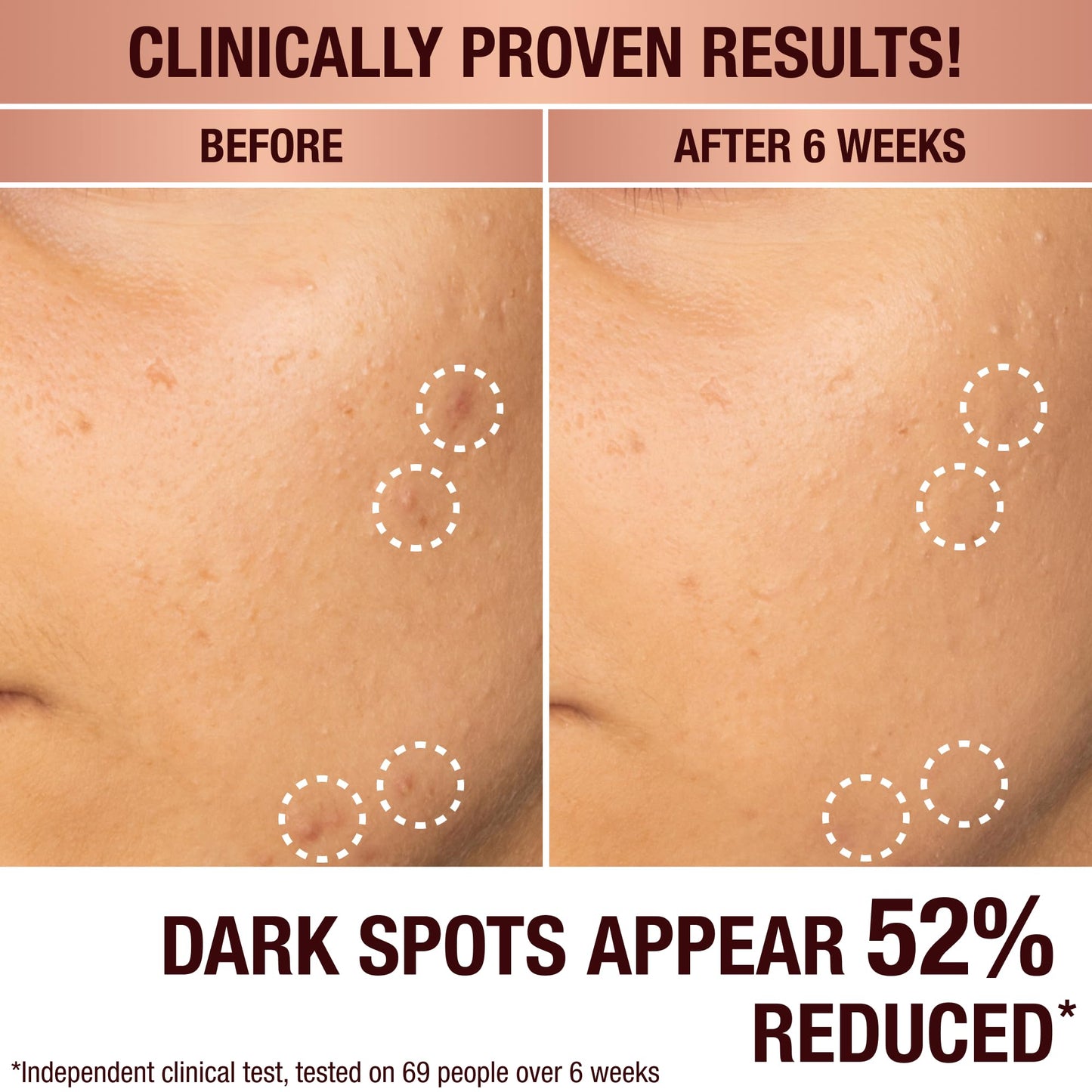 Charlotte Tilbury Radiance Recovery Dark Spot Serum - Tranexamic Acid & Vitamin C Serum for Brighter Looking Under Eyes, Redness, Uneven Skin Tone - Treatment to Reduce Appearance of Aging Skin (10ml)