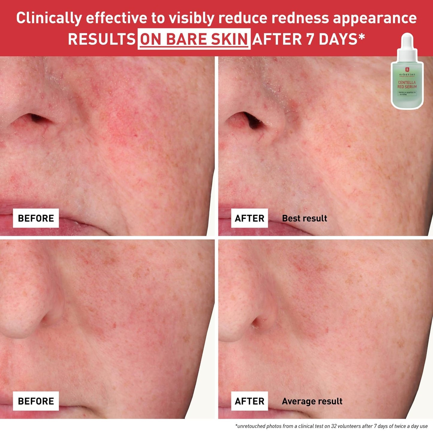 Erborian Red Serum, Daily Hydrating & Soothing Redness Treatment for Sensitive Skin, Lightweight Barrier Support with Centella, Korean Skincare
