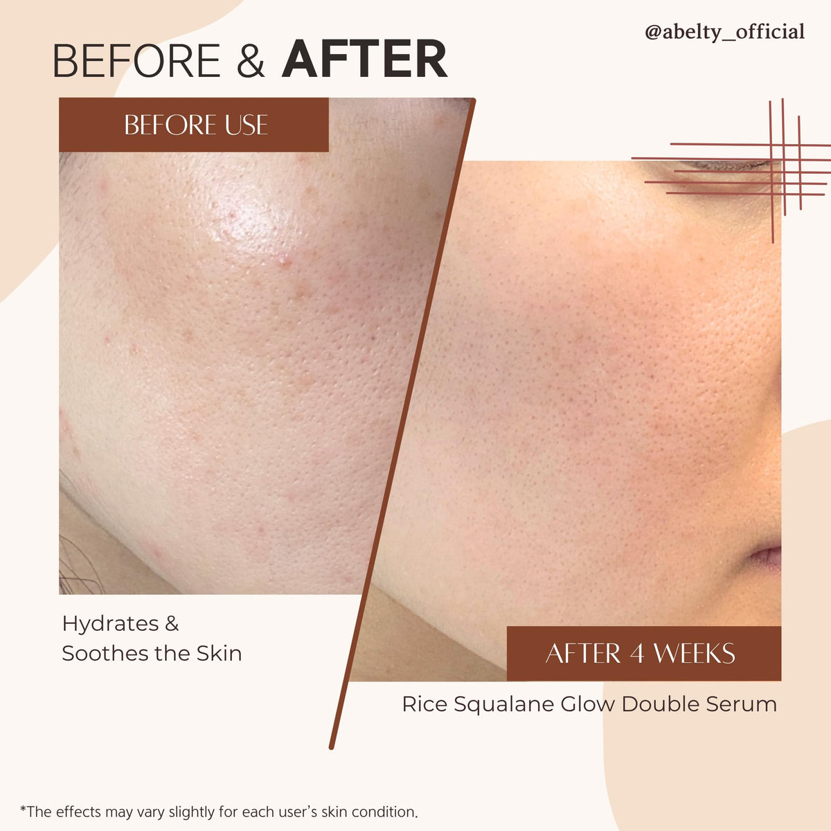 ABELTY Rice Squalane Glow Double Serum – Korean Hydrating Skincare with Olive Squalane 5%, Rice Extract, Niacinamide, Hyaluronic acid for Glass Skin, Anti-Pigmentation, Even Skin Tone, 50ml/1.69 Fl.oz