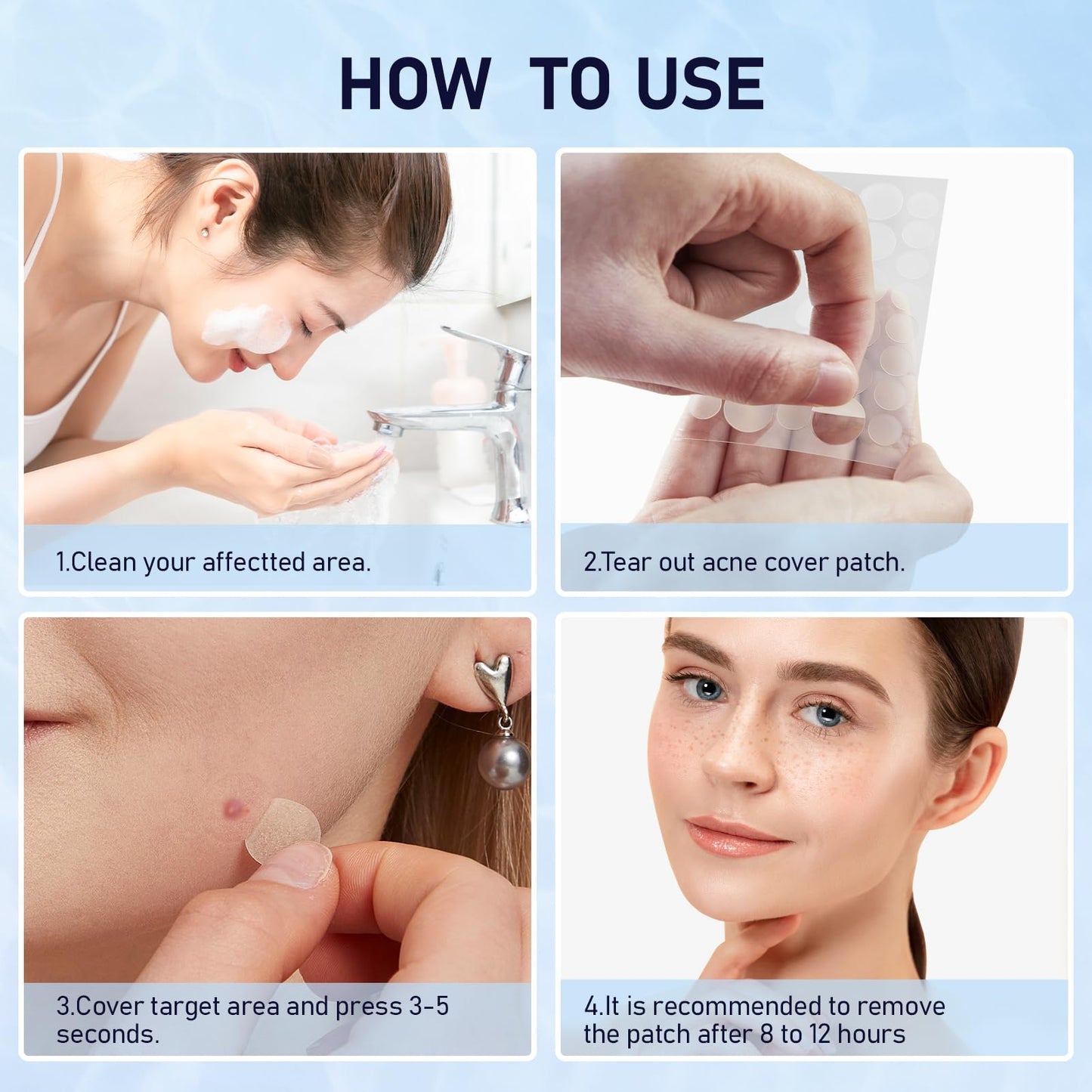 ANGTICS Pimple Patches for Face, 2 Sizes 192 Counts Acne Patches, Hydrocolloid Patches Zit Patches for Skin Care, Blemish Patches Invisible Acne Spot Treatment with Salicylic Acid, Tea Tree Oil