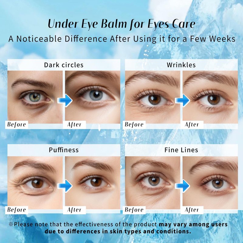 dewyhour Under Eye Balm Stick for Dark Circles and Puffiness - Cooling Moisturizing Eye Cream for Wrinkles & Under Eye Bags | Under Eye Treatment | Korean Skin Care