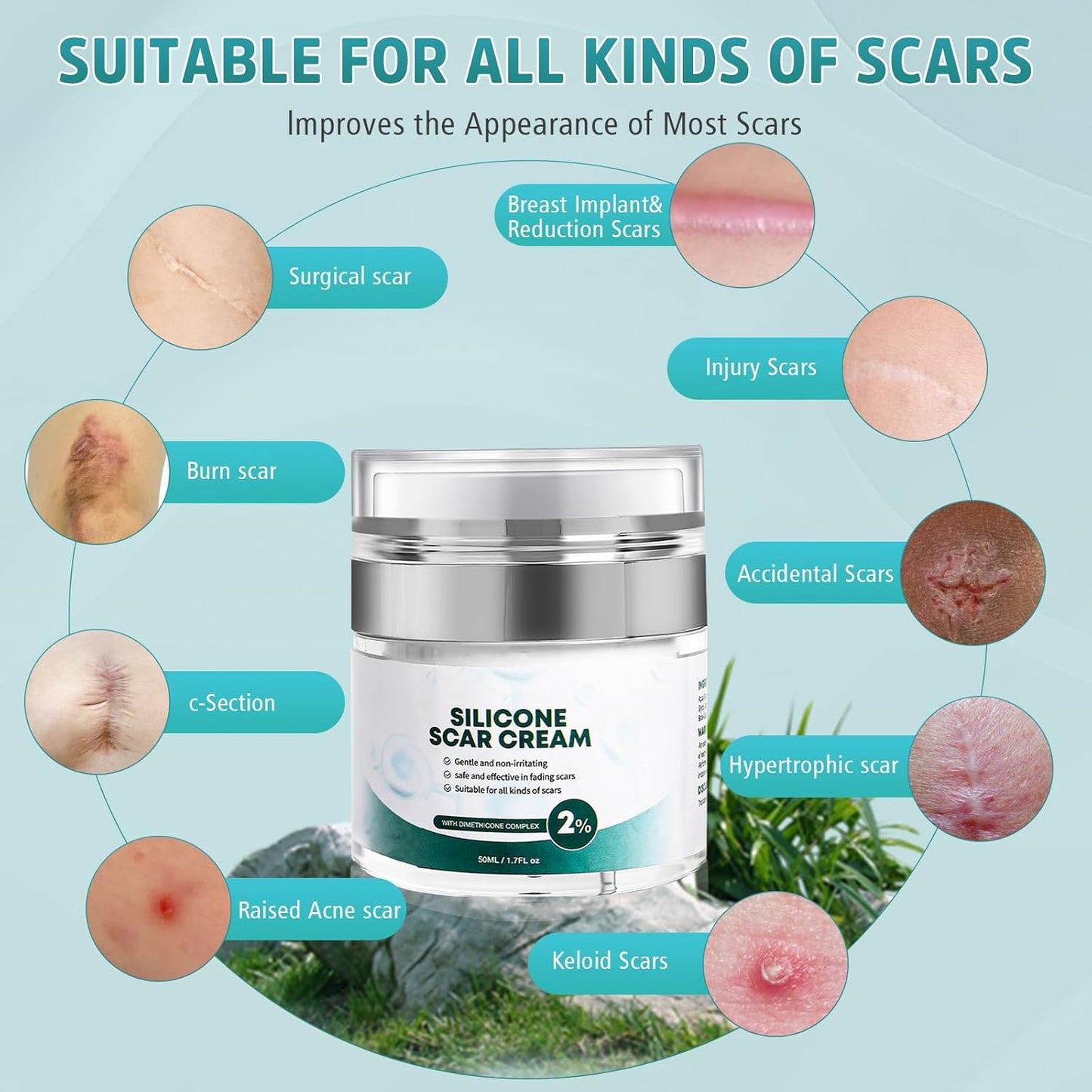 Advanced Scar Cream - Silicone Gel for Surgical Scars, Stretch Marks & More | 1.7 oz (50ml)