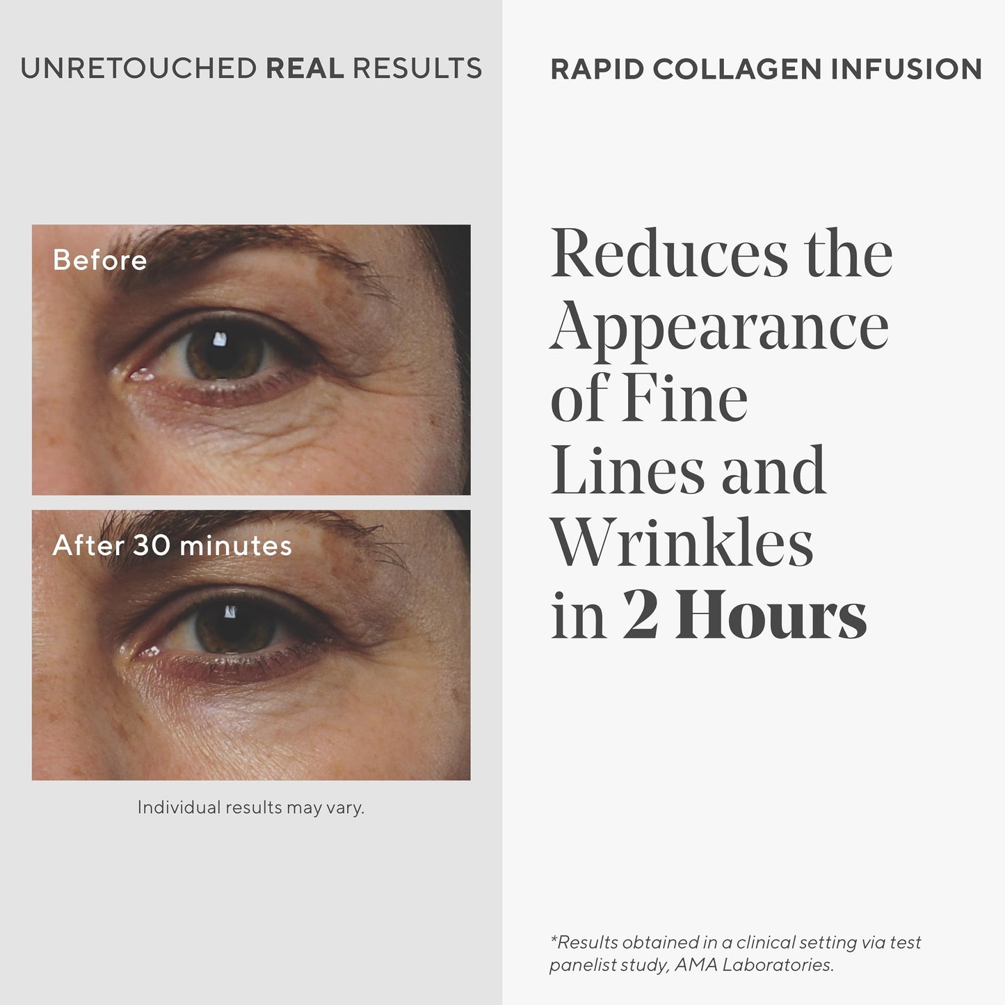 Murad Rapid Collagen Infusion – Anti-Aging Serum with Collagen Amino Acids & Winged Kelp Extract for Visible Wrinkle Reduction, Enhanced Skin Firmness & Re-Volumizes Skin – 1.0 Fl Oz