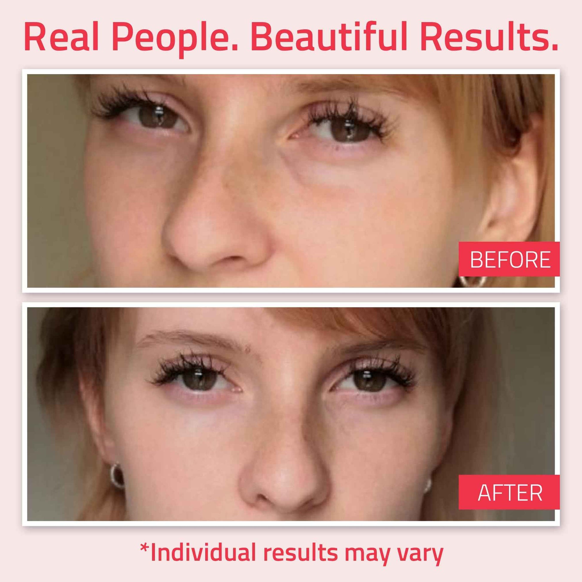 YEOUTH Retinol Eye Cream Anti Aging, Firming Under Eye Cream for Puffiness and Bags Under Eyes for Wrinkles and Dark Circles with Hyaluronic Acid and Tripeptides 1oz