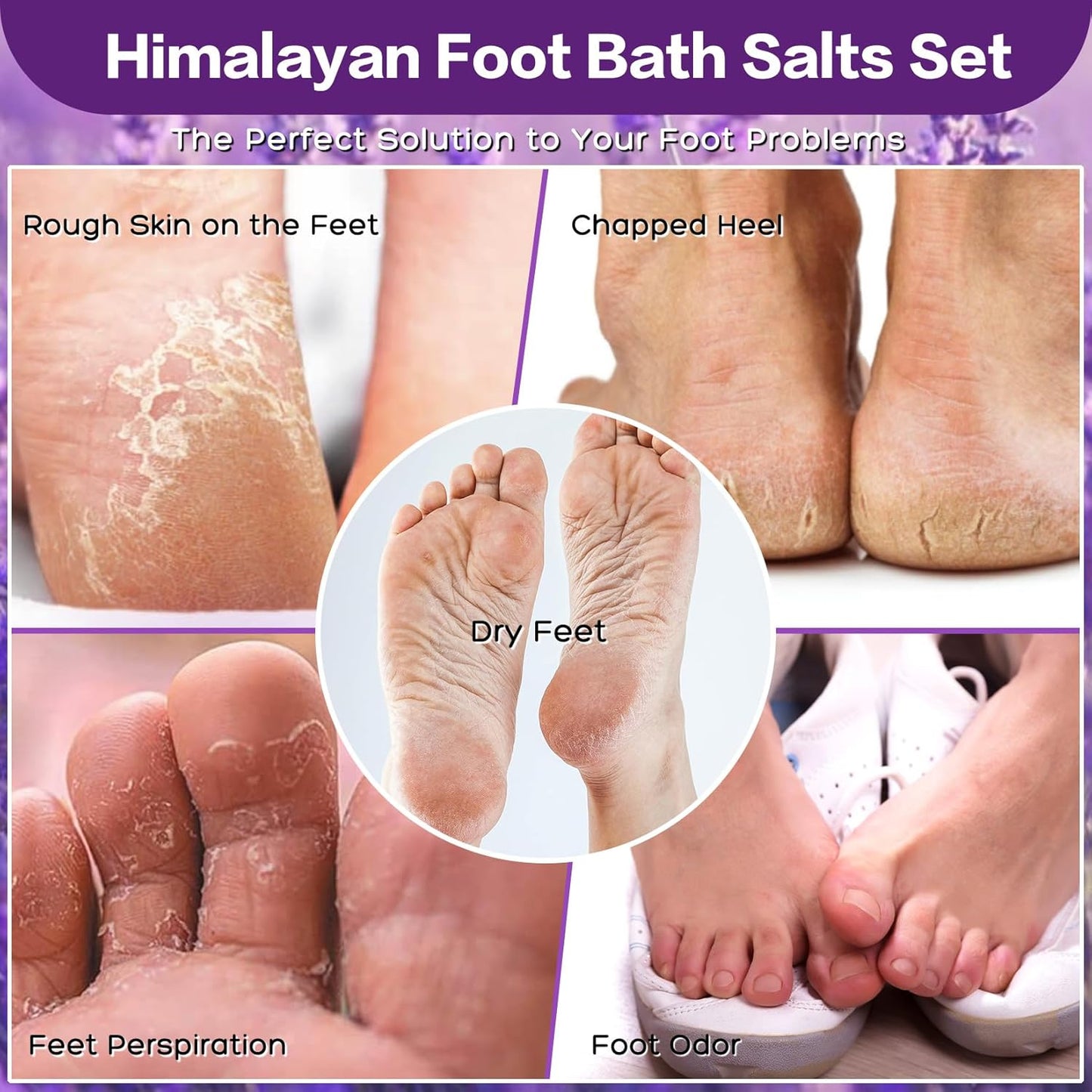 Himalayan Pink Salt Foot Soak Salts Kit - Tea Tree & Lavender | 4 Pack for Softening Calluses & Relaxation