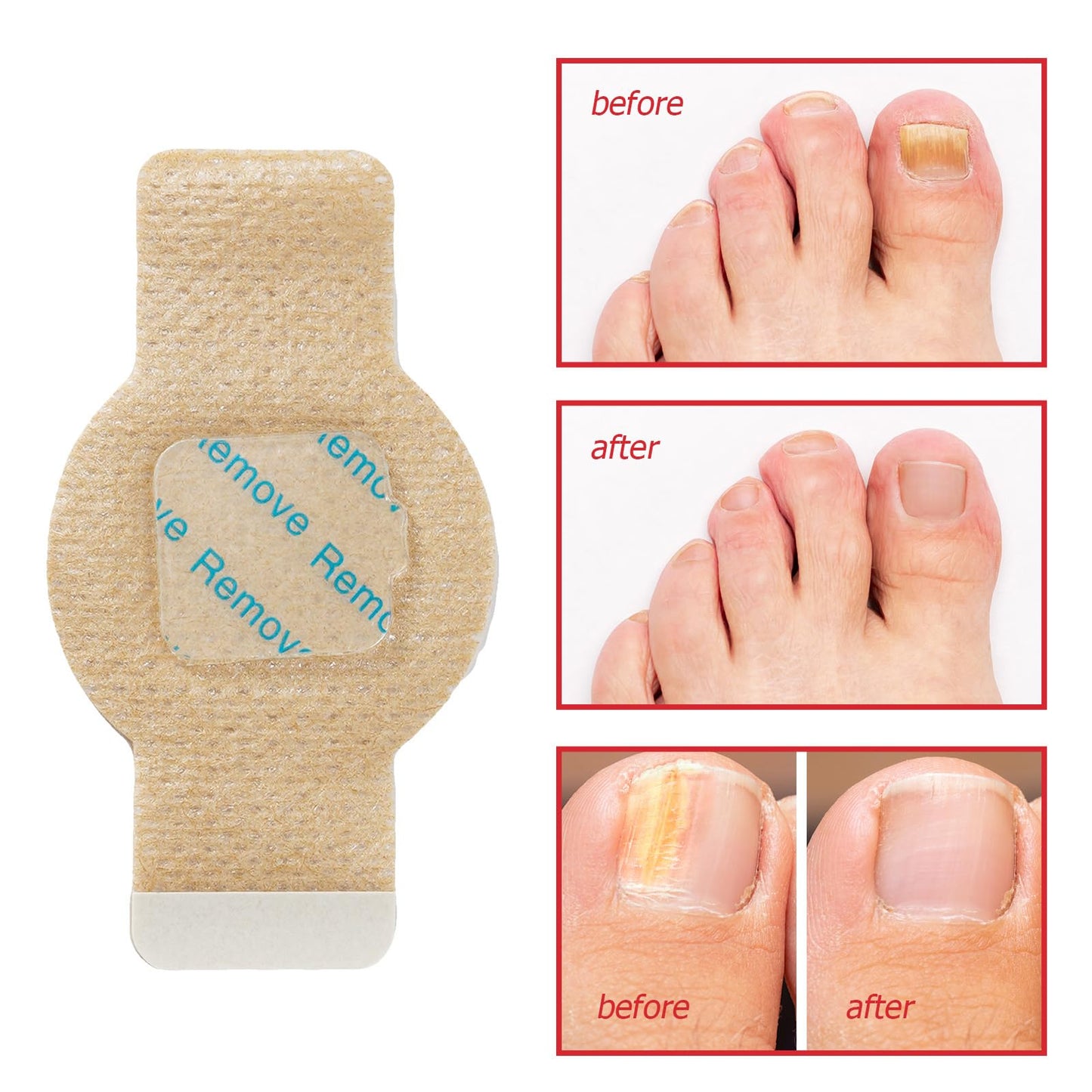 Nail Patches for Toenails & Fingernails – 8-Hour Nail Care Repair Stickers for Extra Strengthening (42pcs)