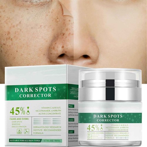Crema para Manchas Oscuras en La Cara, Cremas para Quitar Manchas de La Cara, Crema para Las Manchas de La Cara, 50 ML / 1.7 FLOZ