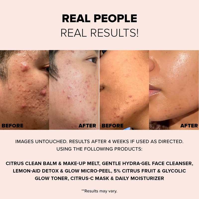 Nudestix Lemon-Aid Detox & Glow Micro-Peel – 3-in-1 Enzyme Face Exfoliator with AHAs, Vitamin C & Fruit Extracts for Bright, Smooth Skin | Clean, Vegan, Pore Detoxifying Peel