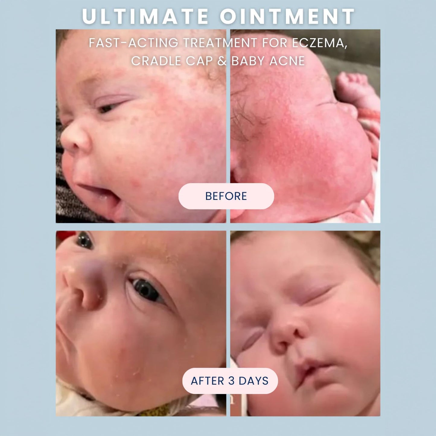 Noodle & Boo Ultimate Baby Ointment for Eczema and Diaper Rash Healing, 3.4 Oz