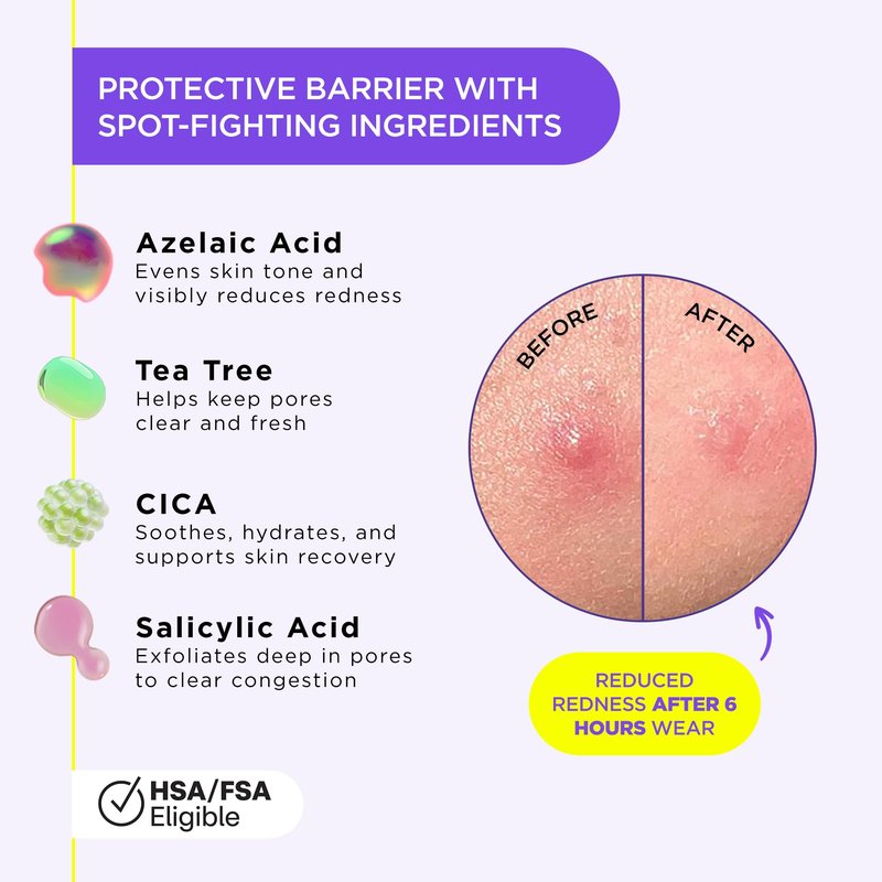 ZitSticka Liquid Pimple Patch - Invisible Pimple Patches for Face, Pimple Cream, Salicylic Acid Spot Cover For Face, Liquid Pimple Patch Large & Clear Fits to Makeup (Liquid Patch 0.3oz,10ml)