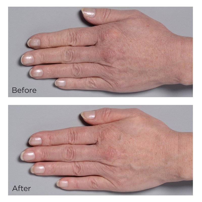 Cold Plasma Plus+ Hand Therapy, 2 fl. oz.