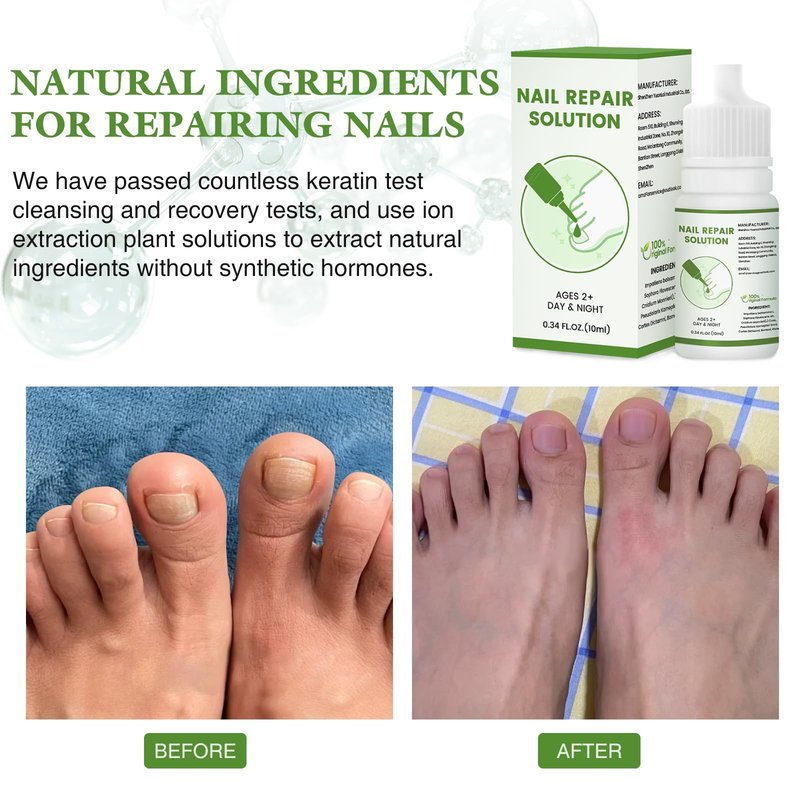 Nail Drops for Treating Toenail Odor and Fungal Infections, and Nail drops
