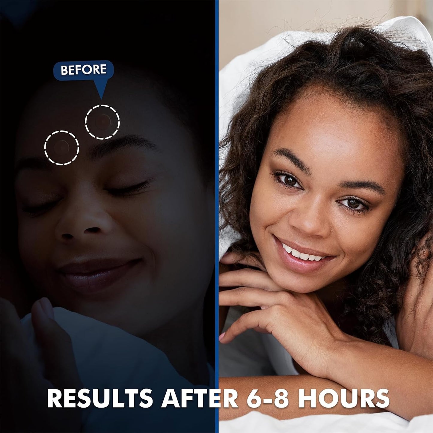 Albatross Health New England Invisible Pimple Patches for face, plain Hydrocolloid Acne Patches, HSA FSA eligible, Spot Dots Cover, Zit Blemish Patch, 2 Sizes 180 Counts