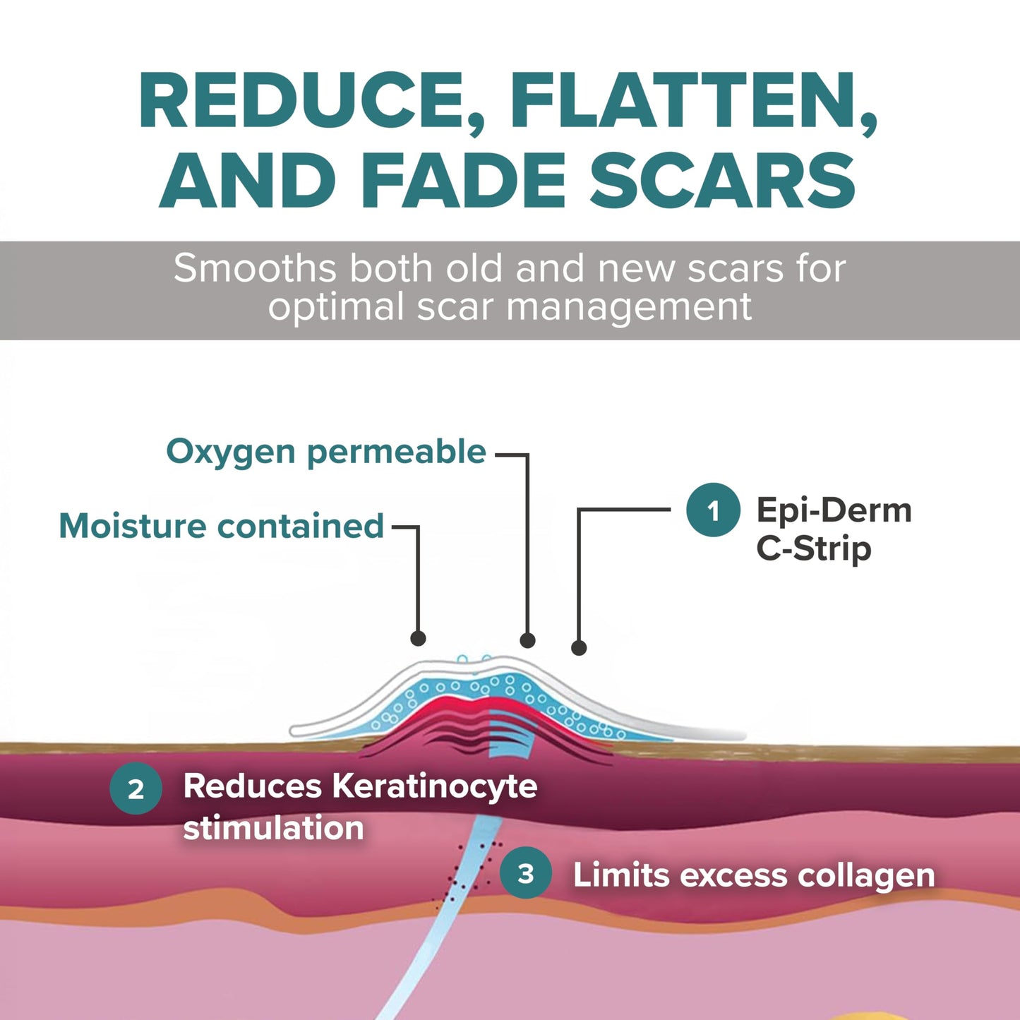 Epiderm Silicone Gel Strips - Silicone Tape for Scar Care - C Section, Tummy Tuck Tape & Cardiac Surgery Scars - Flexible & Reusable Strips - 1.4"x6" Clear