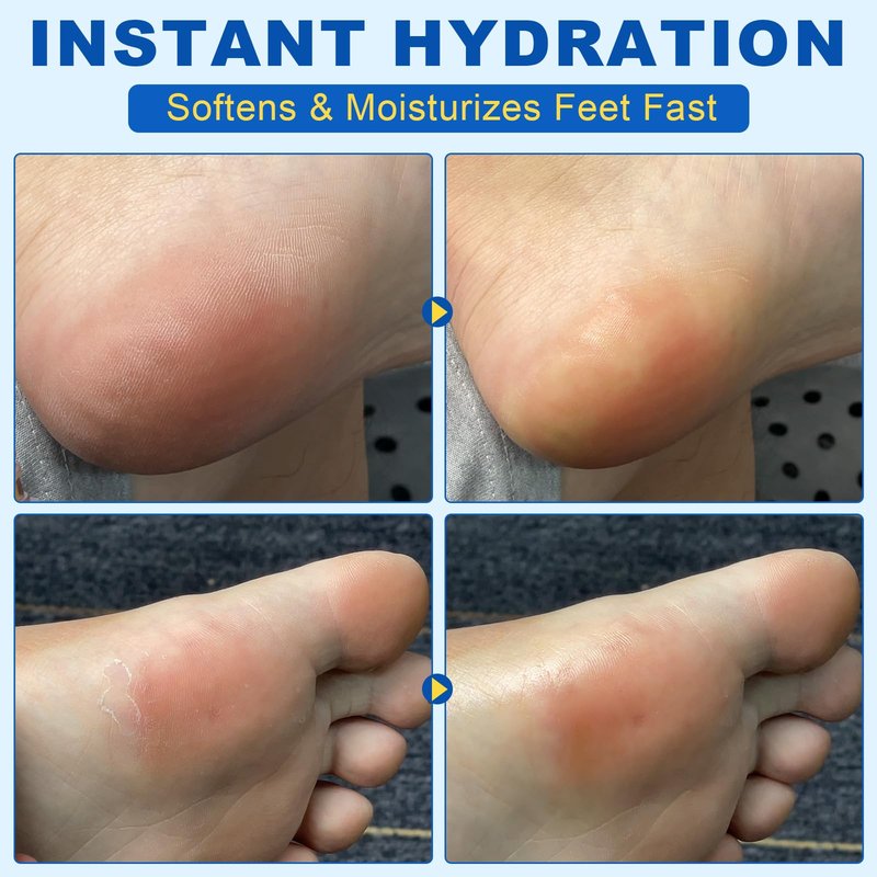 ConfidMiss Foot Care Stick with 60% Urea 2% Salicylic Acid Aloe Vera coconut tea tree oil, Foot Callus Dead Hard Skin Remover Moisturizer for Rough Dry Cracked Feet, Knees, Elbows, Hands Repair Stick