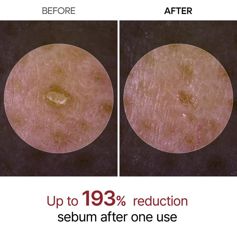 Dr.Melaxin Peel Shot Glow White Rice Peeling Ampoule with Rice Extract & AHA BHA, Brightening & Gentle Exfoliating Serum for Sebum Control, Niacinamide & Hyaluronic Acid, Korean Skincare, 2.71 fl.oz