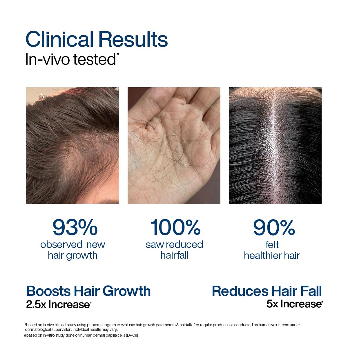 WishCare Hair Growth Serum Concentrate - Rosemary, 3% Redensyl, 4% Anagain, 2% Baicapil, Caffeine, Biotin, Plant Keratin & Rice Water