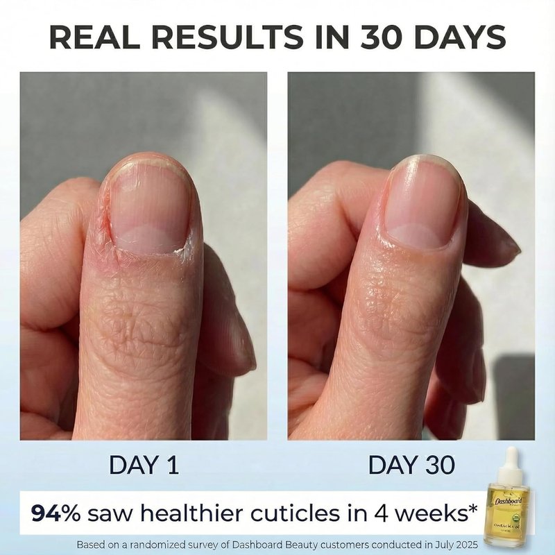 Cuticle Nail Oil - Advanced Moisturizer & Strengthener with Jojoba & Vitamin E | Repairs Damaged Nails, 1 oz