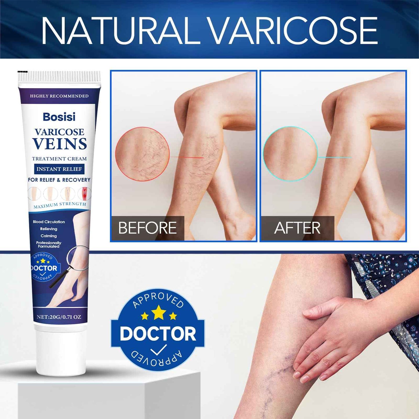 Bosisi Varicose Veins Treatment for Legs