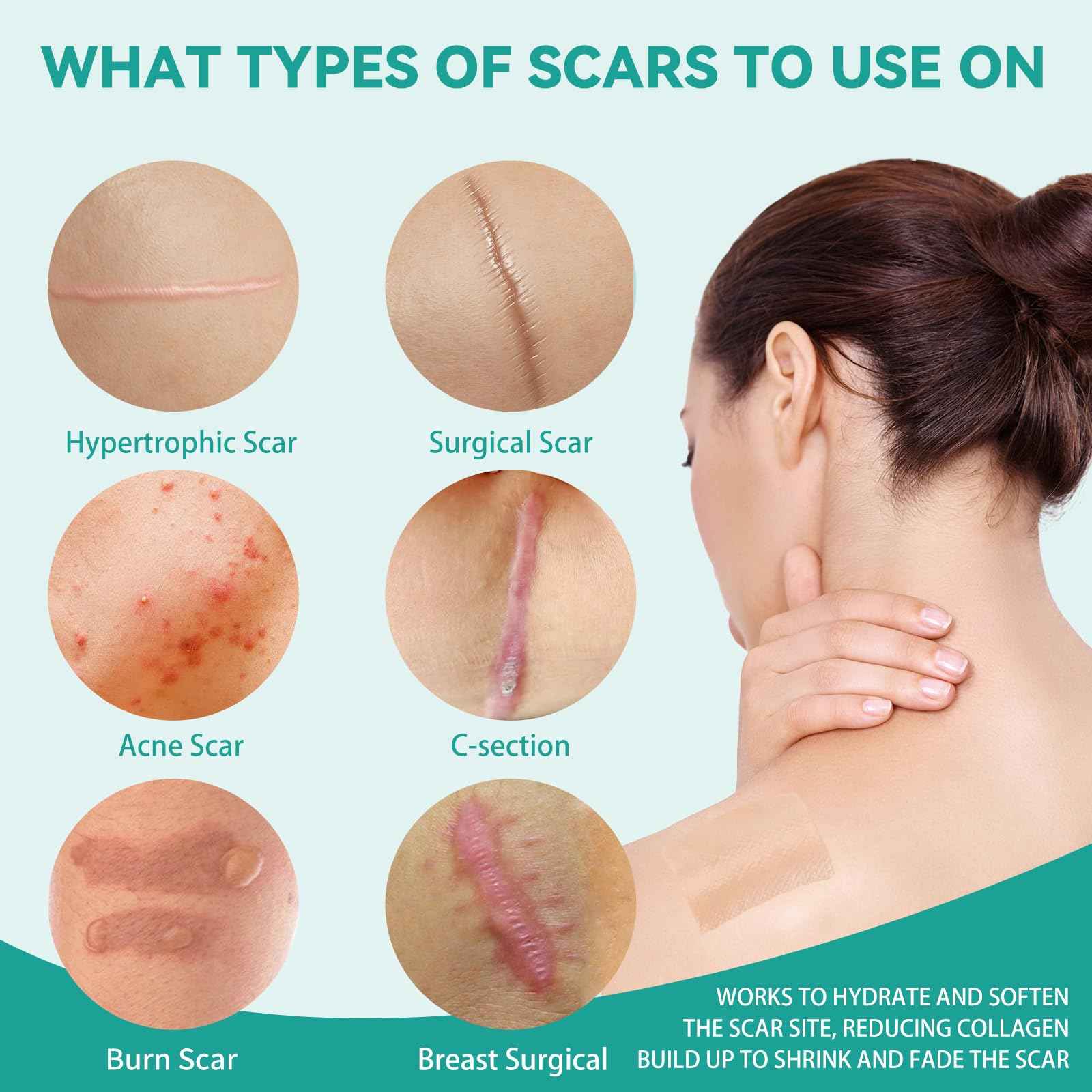 Silicone Scar Tape, Silicone Scar Sheets(1.6"X 120" Roll-3M), Reusable Medical Grade Silicone Tape for Scars, C-Section, Keloid, Acne, Tummy Tuck, Surgical Scars, Light