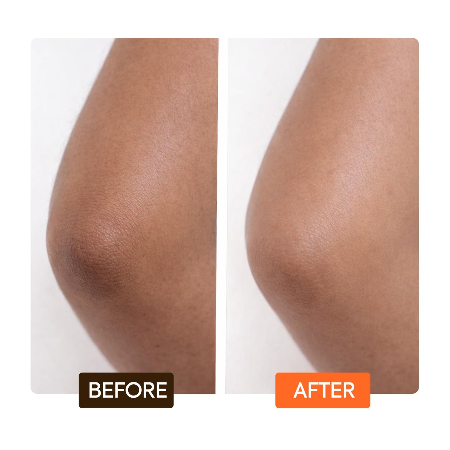 MAKARI Carotonic Extreme Body Lotion (17.6 oz) | Fights Excess Oil Production | Helps Fade Body Scars and Marks | Skin Brightening Formula | Helps Resist Aging and Promotes Healthy Radiance