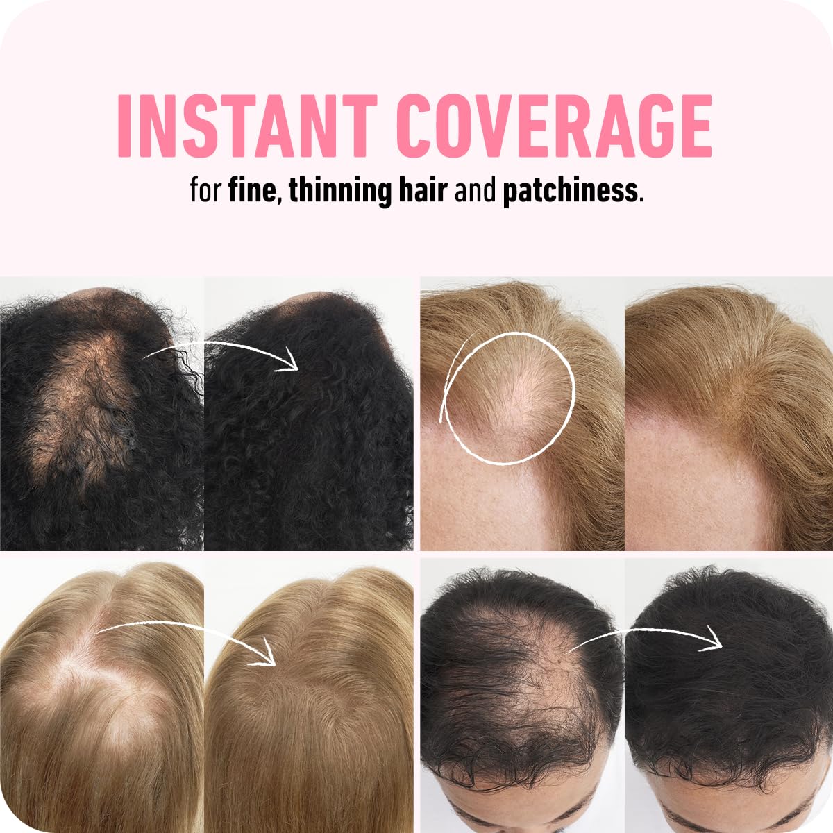 BOLDIFY Hair Fibers (28g) - Fill In Thinning and Fine Hair for an Instantly Fuller, Thicker Look - 14 Shades for Women & Men - Black