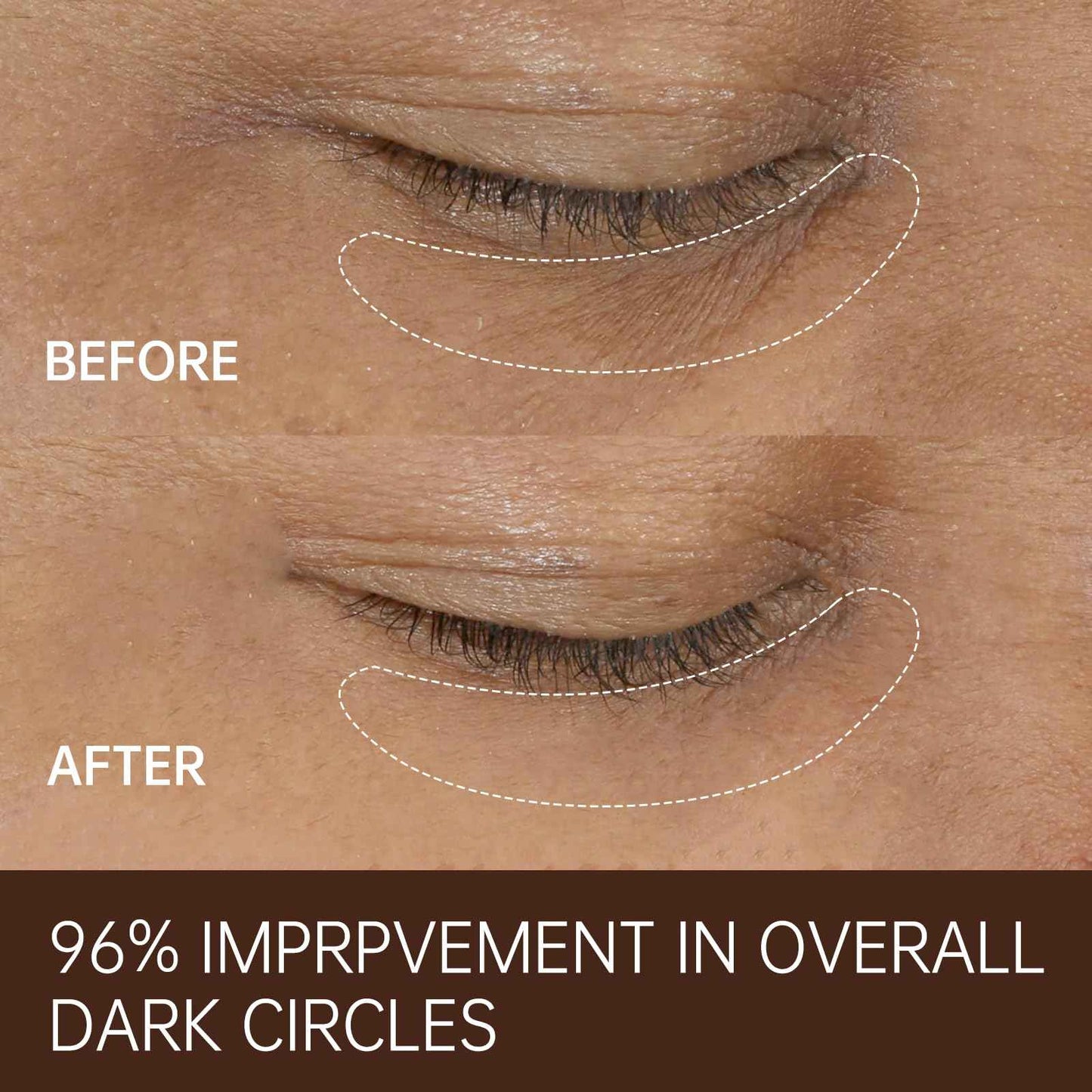 FREEMOOD Eye Cream for Dark Circles,Anti-Aging Under Eye Cream with Caffeine,Hyaluronic Acid to Fight Fine Lines,Hydrating Eye Care Serum,1 fl.oz