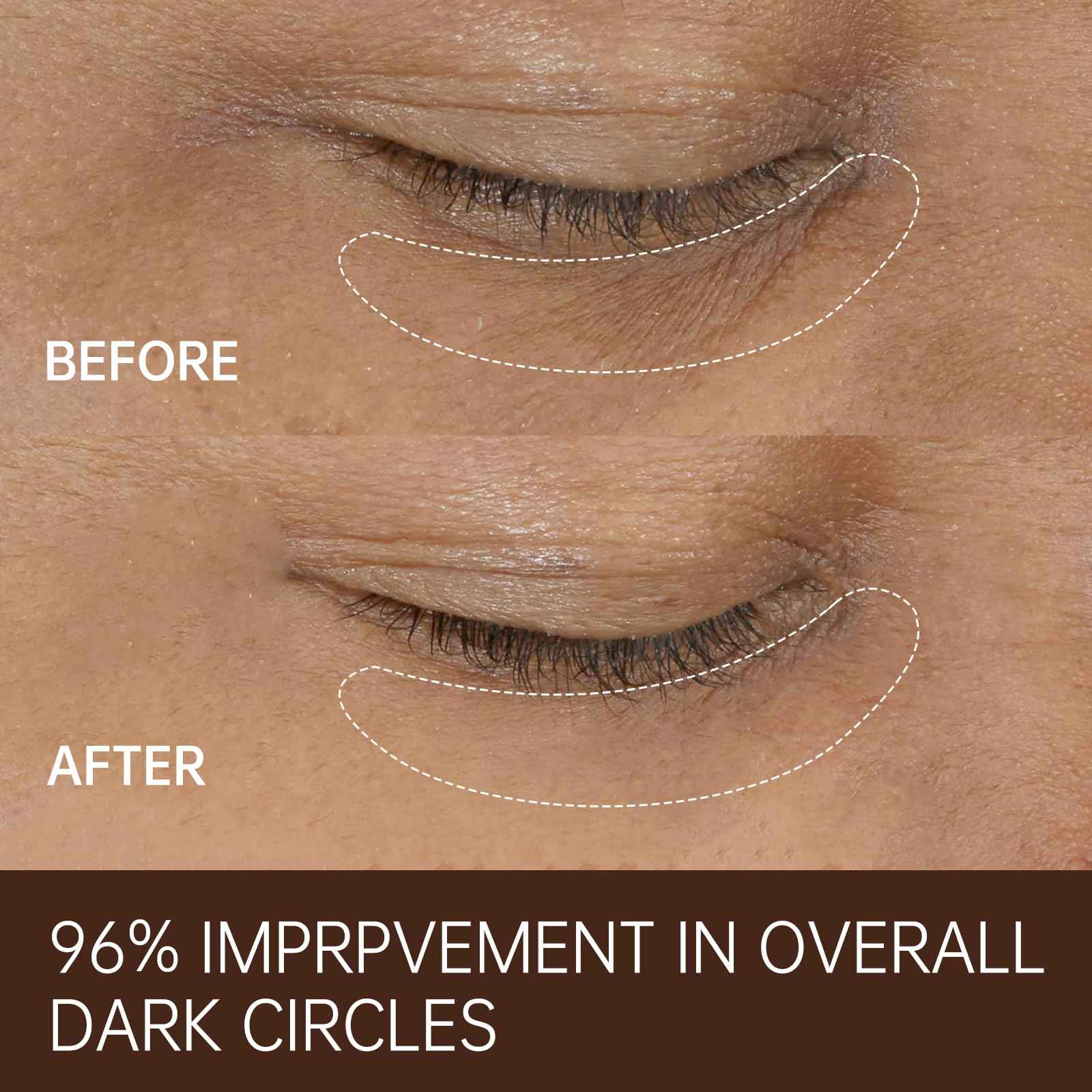 FREEMOOD Eye Cream for Dark Circles,Anti-Aging Under Eye Cream with Caffeine,Hyaluronic Acid to Fight Fine Lines,Hydrating Eye Care Serum,1 fl.oz