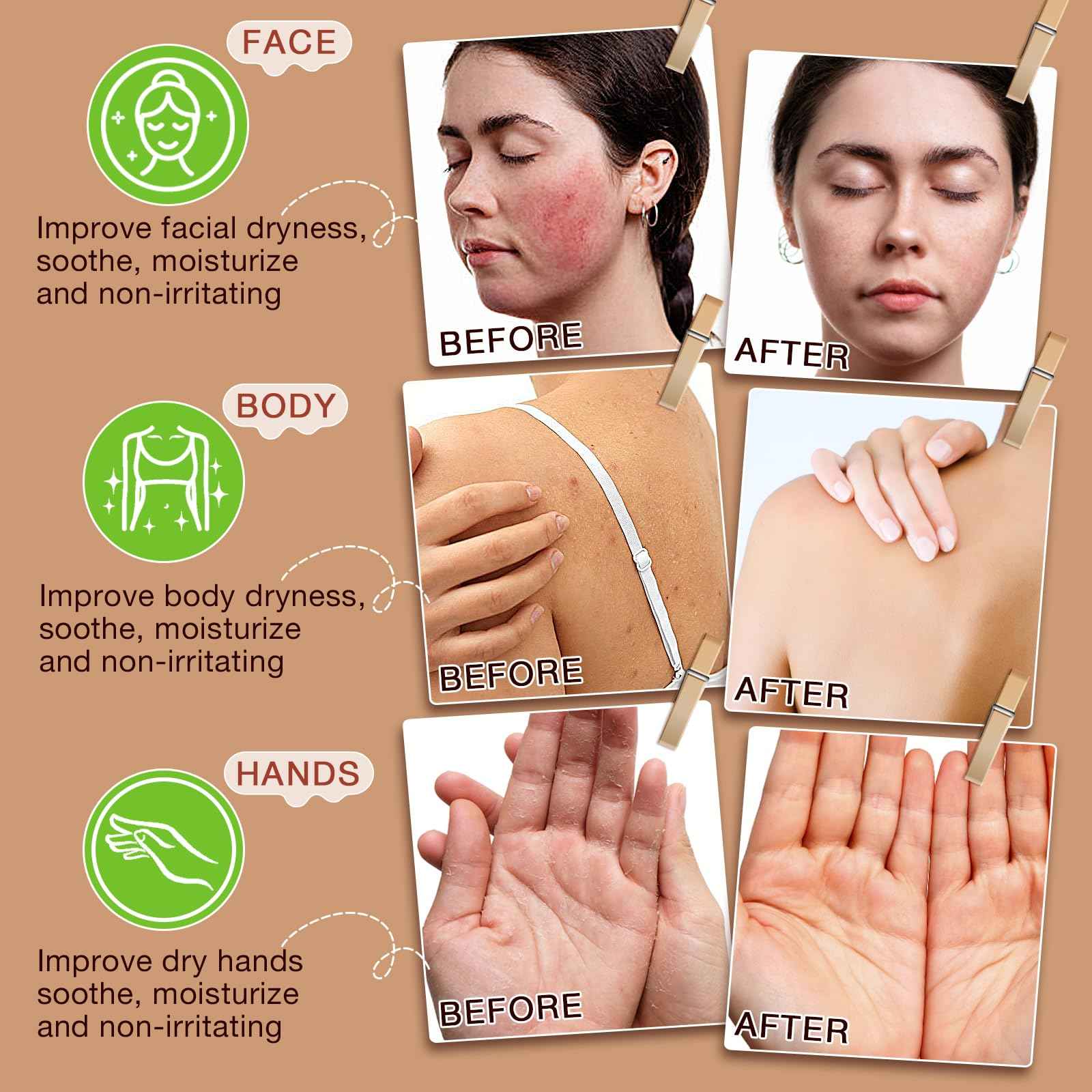 GOGIFTGO Beef Tallow for Skin,Tallow and Honey Balm,Beef Tallow for Face,Tallow Face Moisturizer,Natural Moisturizer Hydrates,Deeply Nourishes the Skin, Enhances Natural Radiance (1pcs)