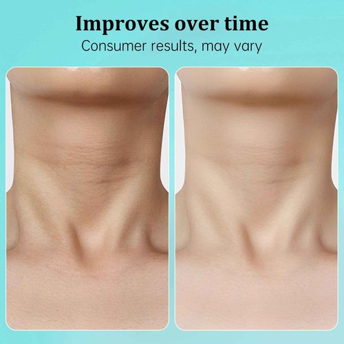 CASAORIGIN Neck Firming Cream, 1.75 oz Neck and Décolleté Cream, Anti Aging Neck Cream for Wrinkles, Skin Tightening and Lifting